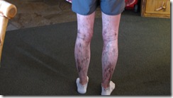 mudy legs 047