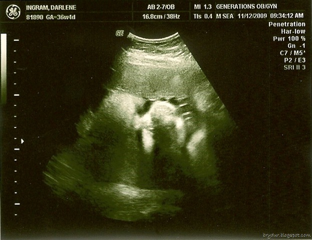 [Ultrasound 11-12-09-1[3].jpg]
