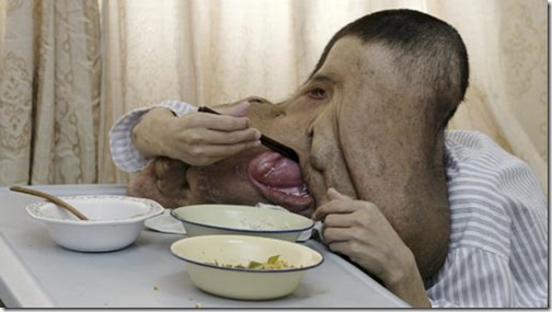 el-hombre-elefante-00003-512x288-la el-hombre-elefante-00003-512x288-la