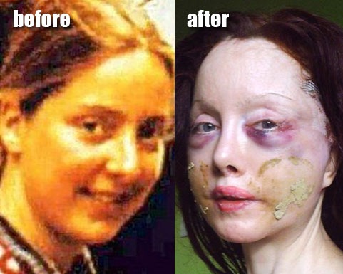 nileen1 nileen1