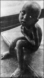 pobreza1