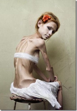 bulimia-anorexia