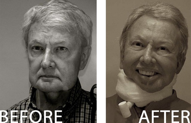 [ebert before after[13].jpg]