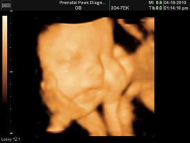 BABY BOY_4
