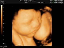 BABY BOY_16