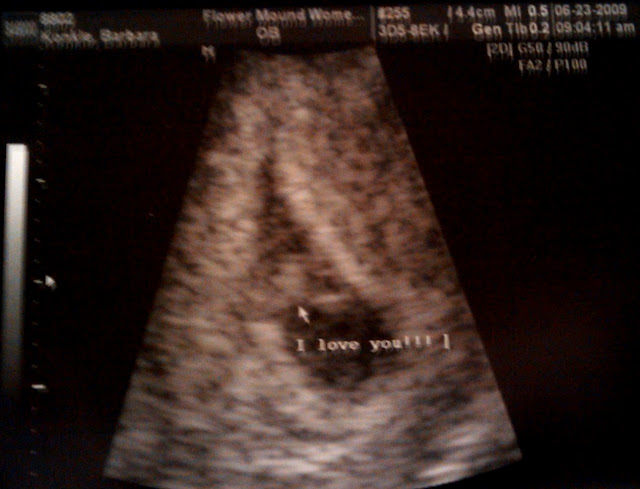 Baby Loves Us.jpg