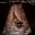 Baby Loves Us.jpg