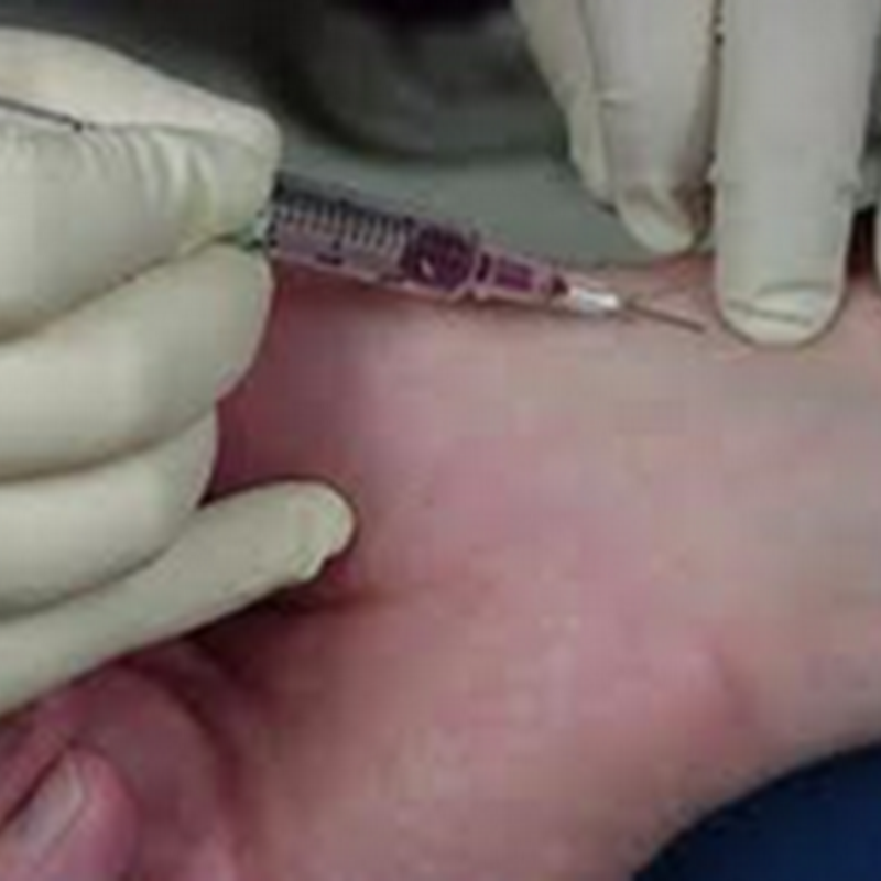 Steps to an Arterial Blood Gas Interpretation