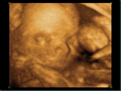 BABY 20 WEEKS_2