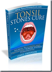 Libro-cura-calcoli-tonsillari