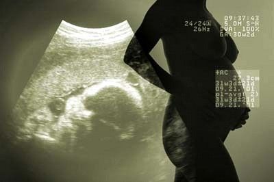 Fetal Ultrasound Image Fetal Ultrasound Image
