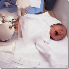 circumcision