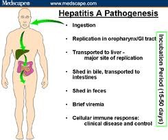 [Hepatitis A[3].jpg]
