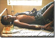 cholera-outbreak assam