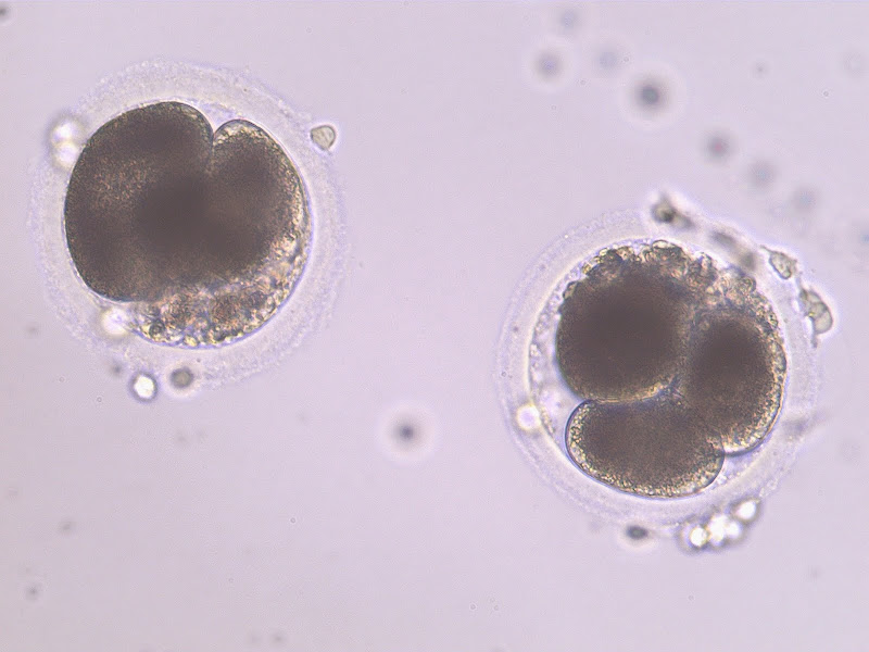 Twin embryos 24 hours post ICSI.