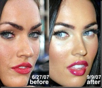 megan-fox-nose-job-300x256