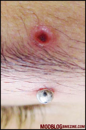 Veja o que que piercings e alargadores podem fazer com você - Parte 2