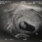 First ultrasound - December 22, 2009 (8weeks 4days)