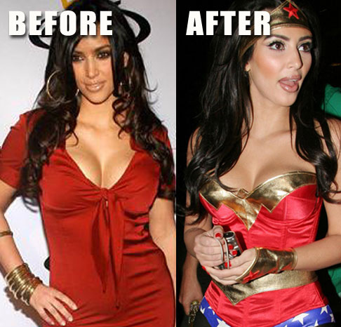 Kim Kardashian Plastic Surgery Before And After Photos And Videos