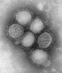 Swine Flu Swine Flu