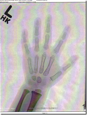 x ray