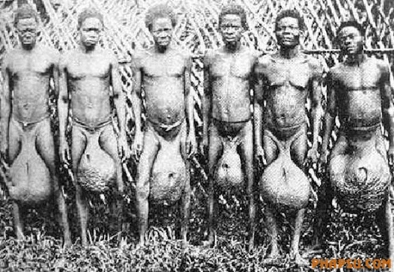 deformities_08.jpg?imgmax=576