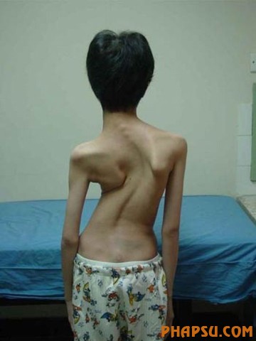deformities_21.jpg?imgmax=576