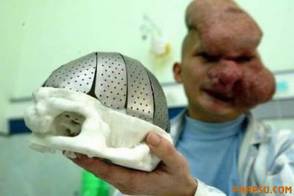deformities_24.jpg?imgmax=576
