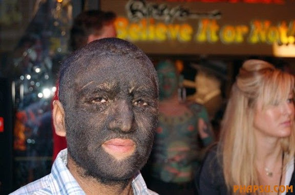 deformities_29.jpg?imgmax=576