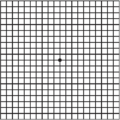 Click here - The Amsler Grid explained - care of the Macular Degeneration Foundation Click here - The Amsler Grid explained - care of the Macular Degeneration Foundation