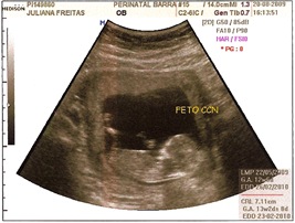 13 semanas 3