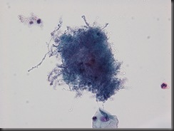 Actinimycese - 40x