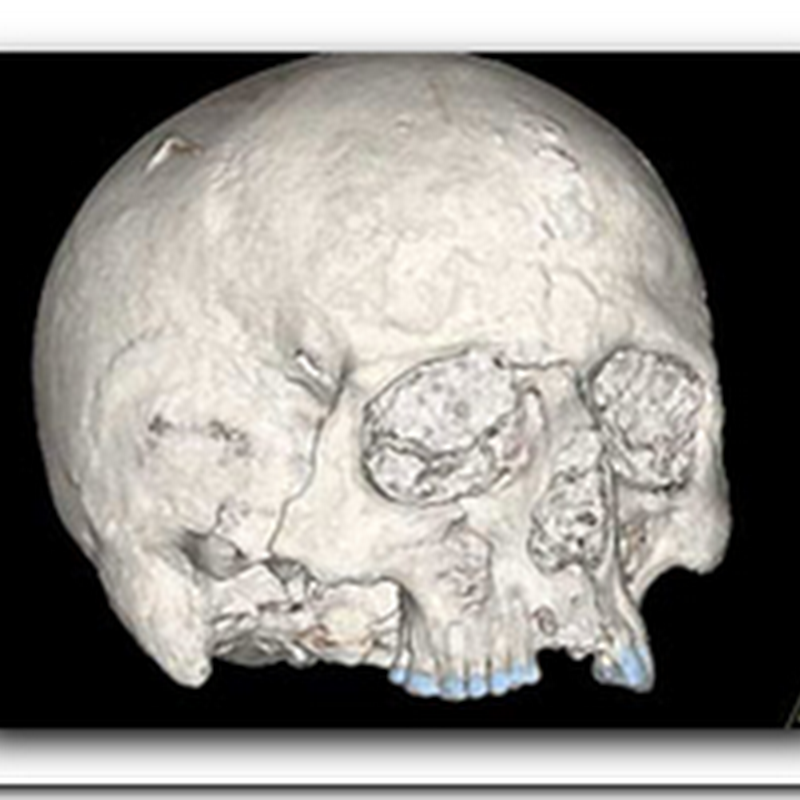 Scientists Find Oldest Human Brain in Britain - Preserved