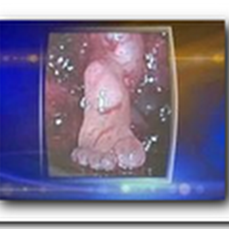 Doctor finds foot growing in brain of infant during surgery