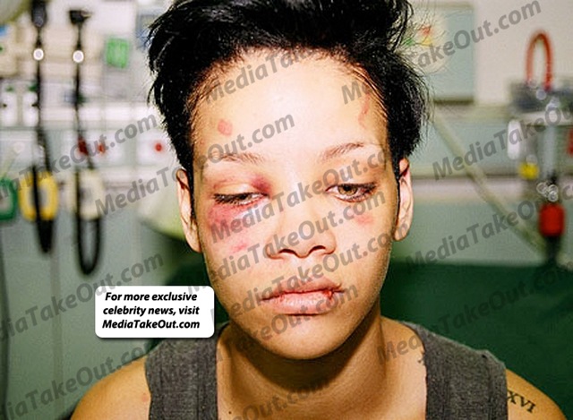 [1298558182rihanna_abuse1[5].jpg]