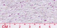 30NPR-11568-Bleaching+OBA