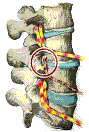chiro-subluxation-normal-nerve-flow