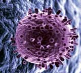 [swine flu[3].jpg]
