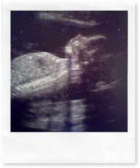 BabyBoypyle20wks3days