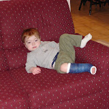 Garrett's Broken Leg