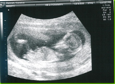 2nd us 2nd baby 002
