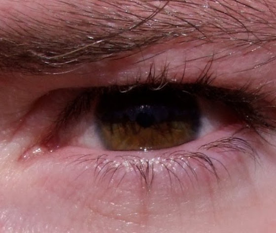 john's eye