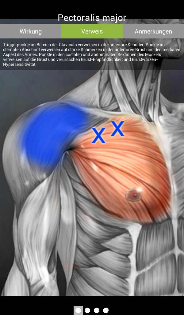 Android application Muscle Trigger Point Anatomy screenshort