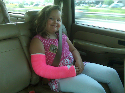 Bab's breaks her arm.