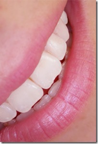 dientes-blancos-blanquear