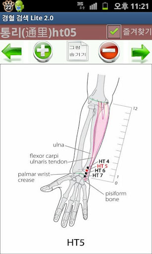 免費下載醫療APP|한의학 경혈 검색 Lite app開箱文|APP開箱王