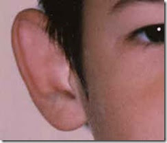 Medicine Decoded: Diseases of External Ear