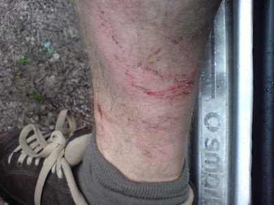 Ouch that stings!