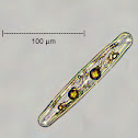Diatom