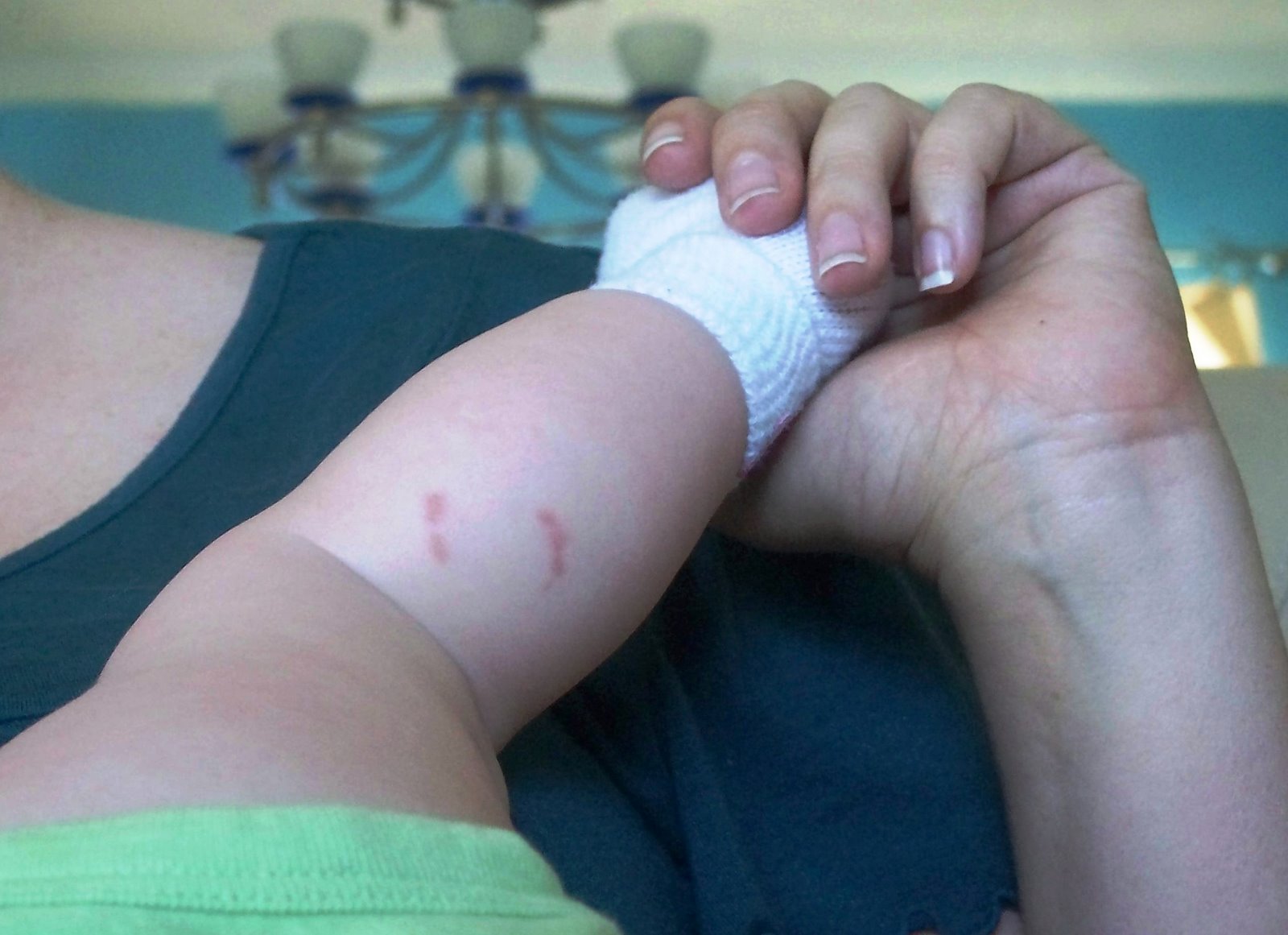 [bite mark 004[3].jpg]